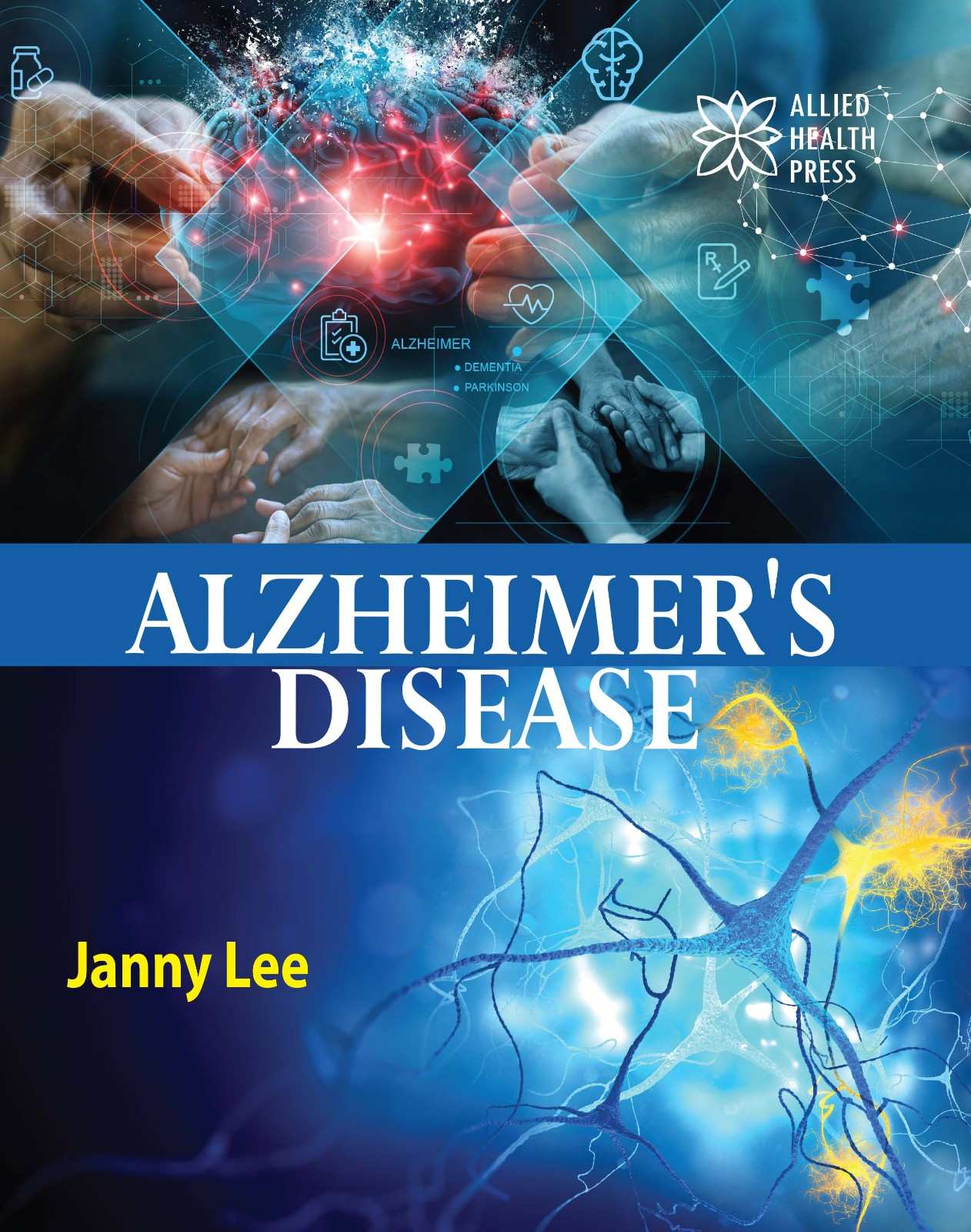 Alzheimer disease