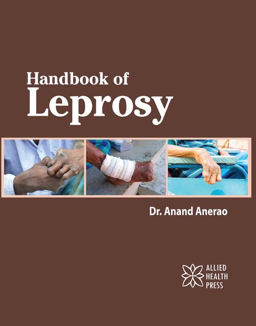 Handbook of Leprosy